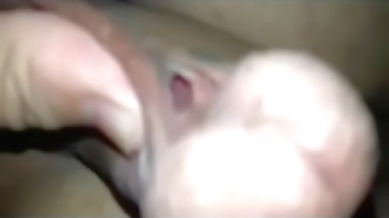 A hypospadias for your viewing pleasure