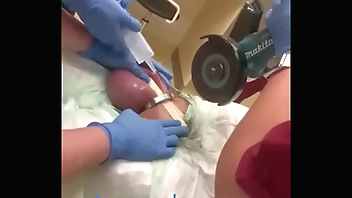 Así le sacaron la tuerca