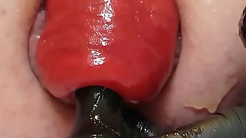 Contender For Biggest Prolapse (Male Warning!)